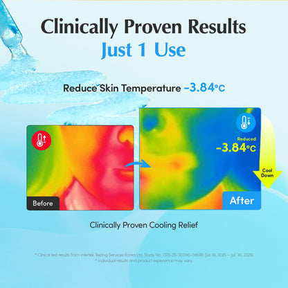 EQQUALBERRY Hyaltoin Flooding Smoothie Serum | 5% Hyaluronic Acid Serum for Face & Redness Relief | Deep Hydrating Cooling Care with 5 Ceramides & Ectoin | Korean Skincare (1.01oz / 30ml)