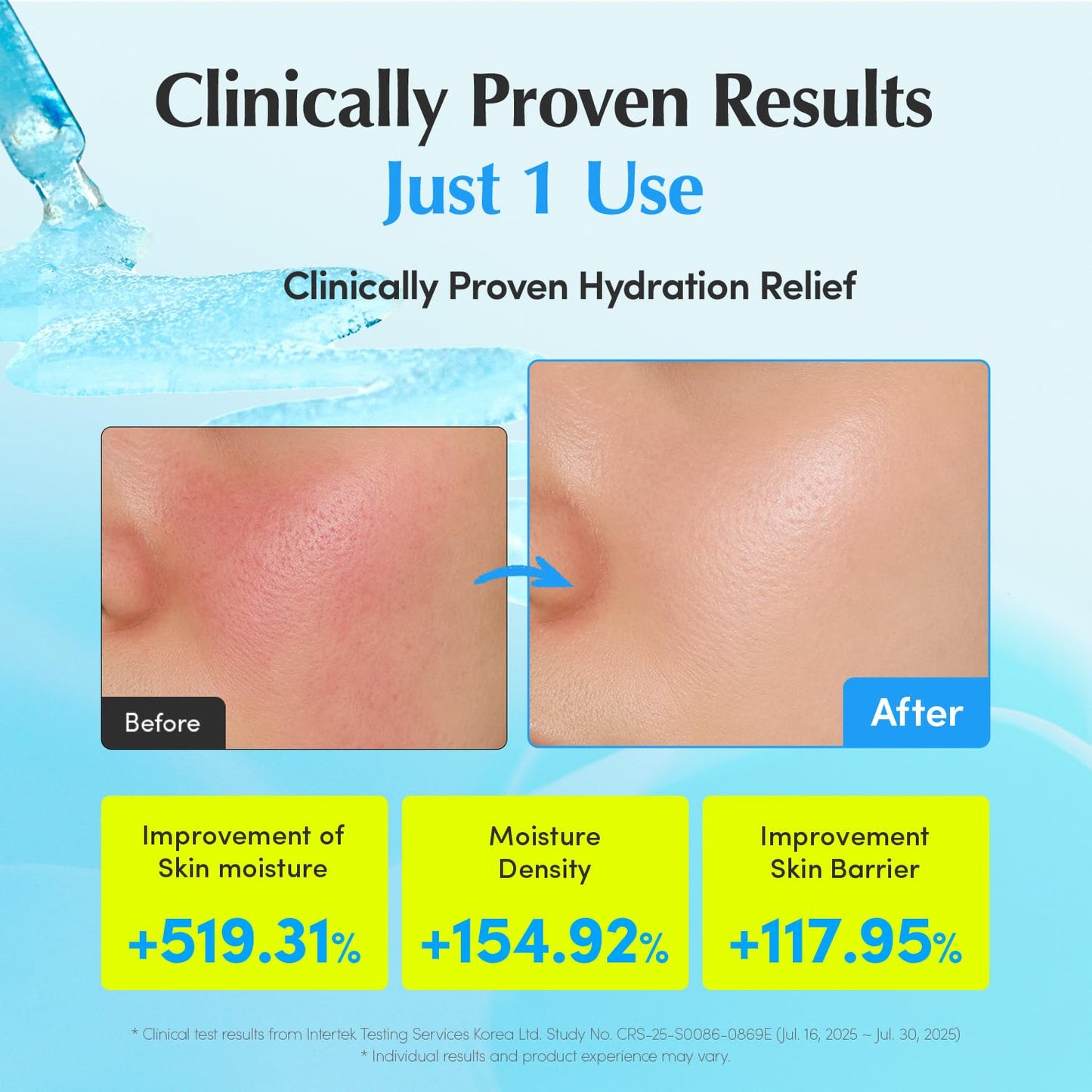 EQQUALBERRY Hyaltoin Flooding Smoothie Serum | 5% Hyaluronic Acid Serum for Face & Redness Relief | Deep Hydrating Cooling Care with 5 Ceramides & Ectoin | Korean Skincare (1.01oz / 30ml)