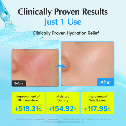 EQQUALBERRY Hyaltoin Flooding Smoothie Serum | 5% Hyaluronic Acid Serum for Face & Redness Relief | Deep Hydrating Cooling Care with 5 Ceramides & Ectoin | Korean Skincare (1.01oz / 30ml)